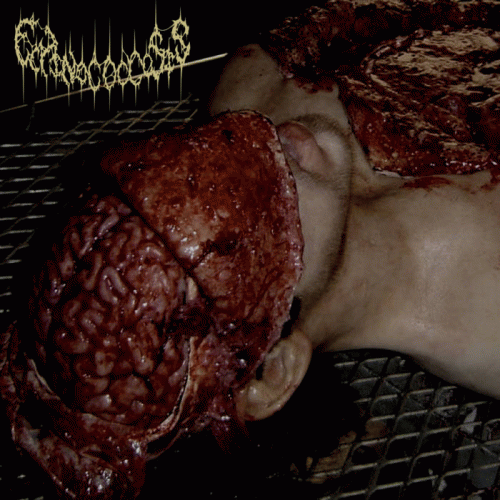 Echinococcosis : Demo 2018